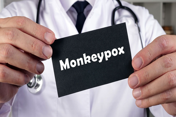 Test de détection d'antigène rapide Streptaquin: cinq choses que vous devez savoir sur Monkeypox